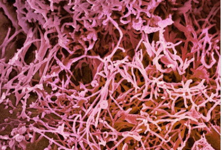 Microscopia-alta-resolución